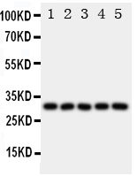 WB - Anti-LOX-1/OLR1 Antibody ABO11140